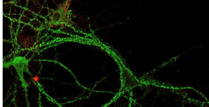 Neuronas del hipocampo