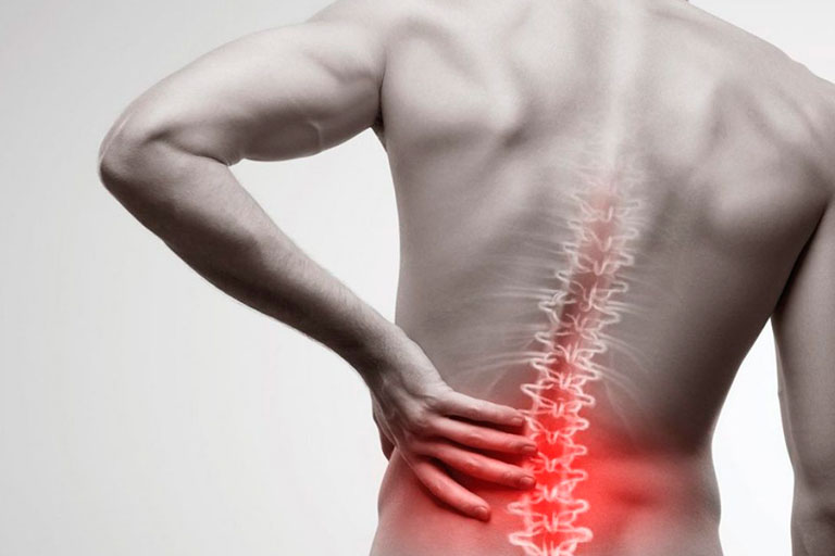 Cómo prevenir las hernias lumbares y las hernias cervicales gracias a la fisioterapia