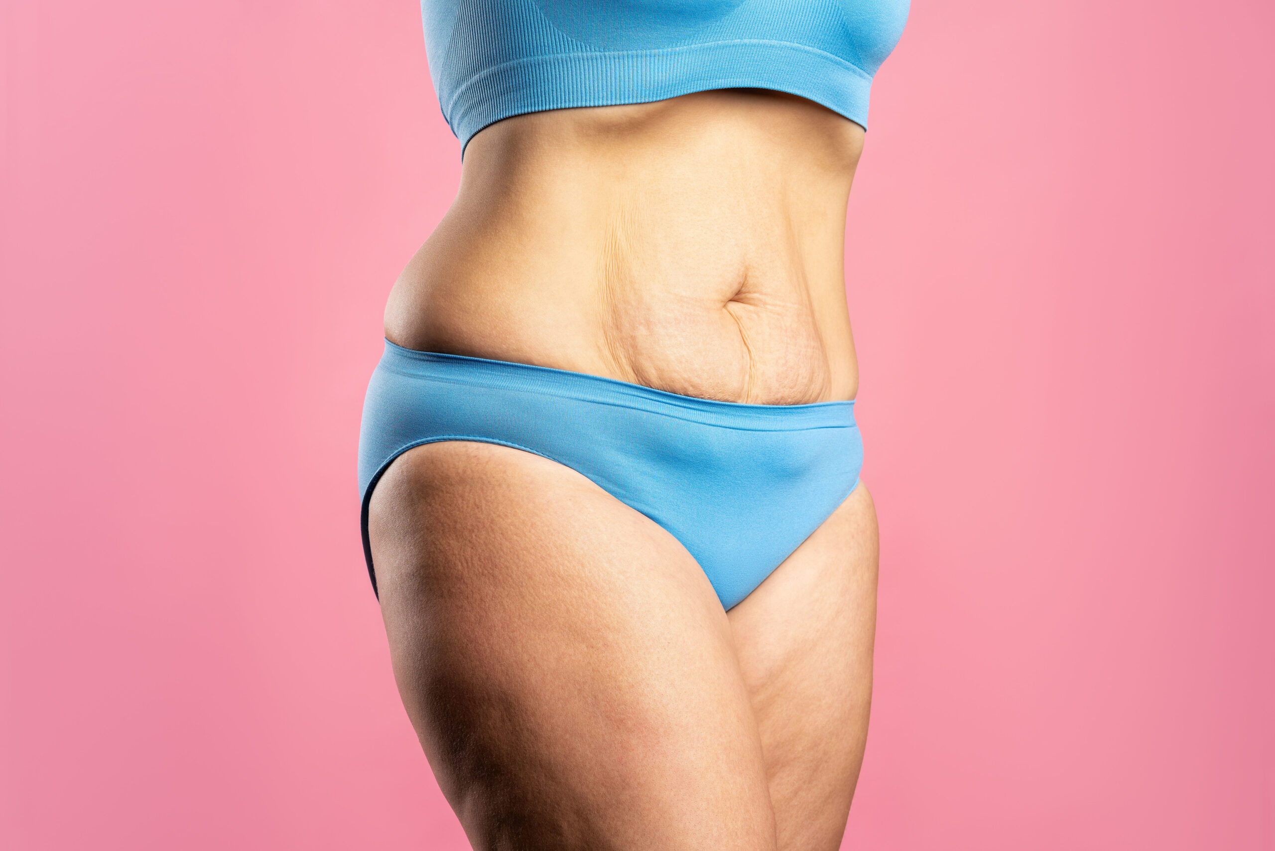 Descubre la Transformación Corporal: Tratamientos en Planas Salud 